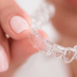 Técnicas de Clareamento Dental