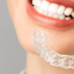 Ofereça clareamento no seu consultório