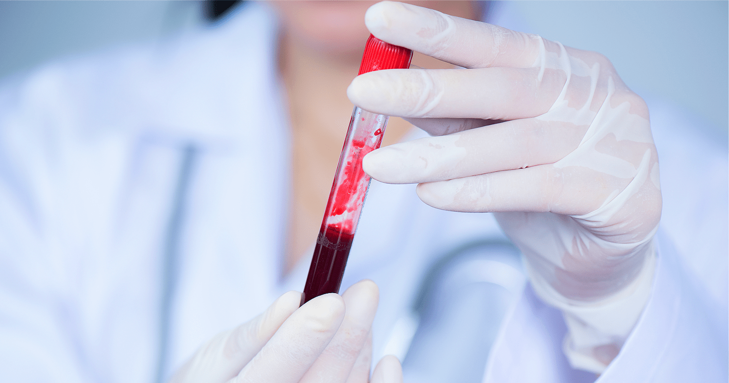Como entender exames de sangue na odontologia