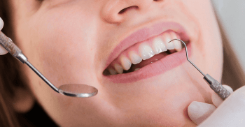 Clareamento dental de dentes não vitais