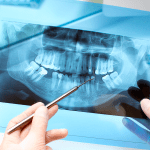 Quando realizar retratamento endodôntico?