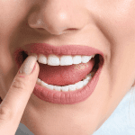 Retratação gengival: Causas e tratamentos