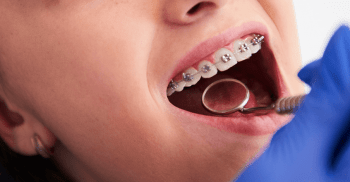 Ortodontia, especialidade mais complexa da Odontologia