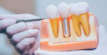 Manequim Odontológico: Como escolher o seu?