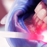 0806 Capa A importância do combate às infecções endodônticas 2 min