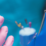 0806 Capa Pulpite reversível e pulpite irreversível 2 min