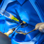 2906 Capa Blog Dicas para escolher a medicação intracanal  min