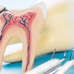 capa tomografia computadorizada