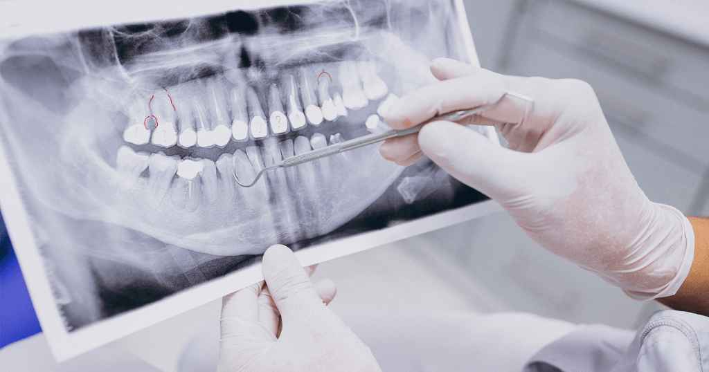 3 dicas de fotografia em Odontologia