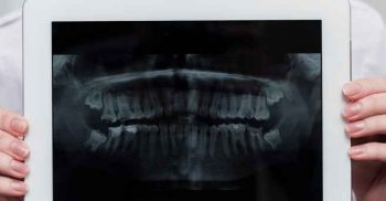 Radiografia Odontológica: saiba tudo!