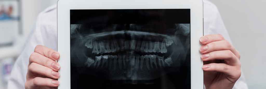 Radiografia-Odontológica