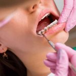 Tratamento Ortodôntico 10 Dicas para contribuir com o êxito