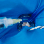 Saiba mais sobre o Isolamento absoluto - Blog Dental Speed