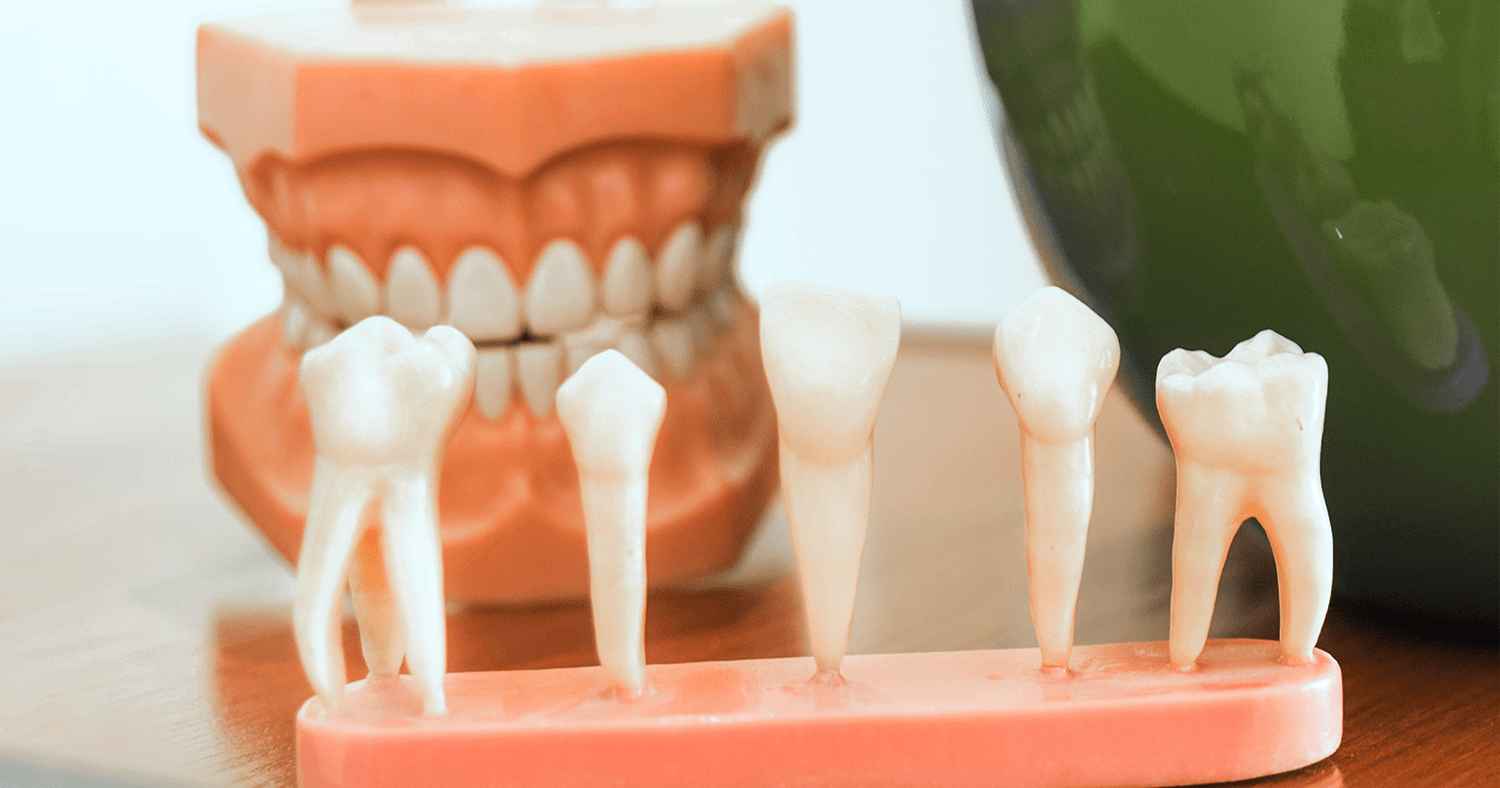manequim arcada dentária com conjunto de dentes de amostragem blog dental speed