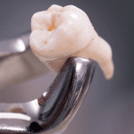 anomalias dentárias