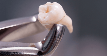 Como diagnosticar anomalias dentárias?