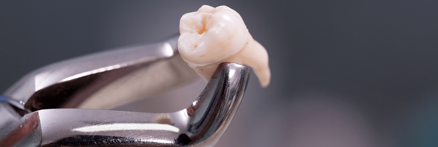 Como diagnosticar alterações dentárias
