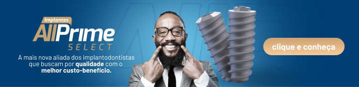 Implantes Allprime Select - ﻿﻿allprime na odontologia