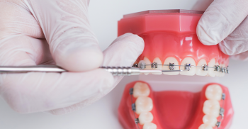 Mitos e verdades da Ortodontia