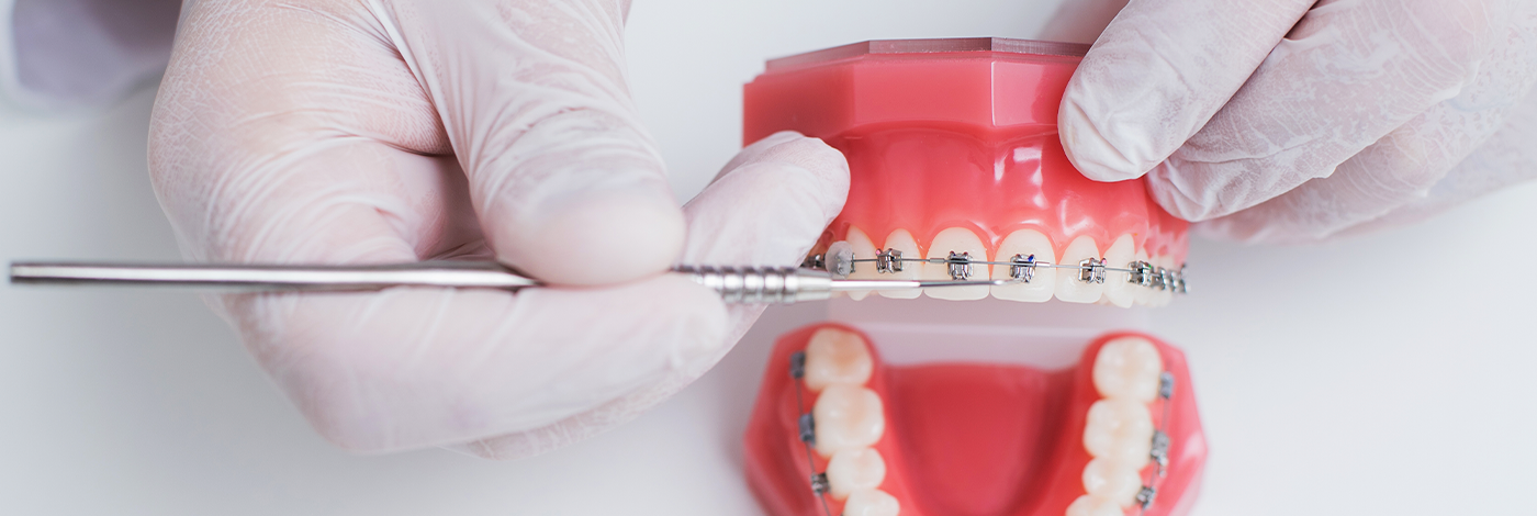 Mitos e verdades da Ortodontia
