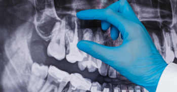 Odontologia Legal: saiba tudo sobre a especialidade