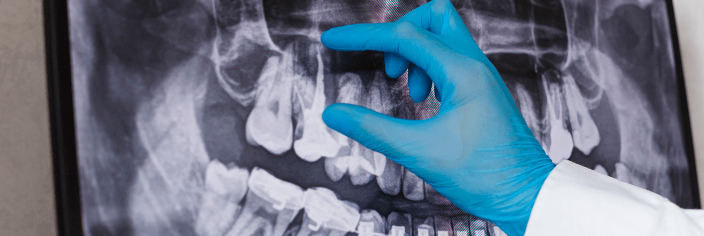 Odontologia Legal: saiba tudo sobre a especialidade