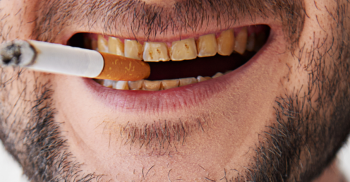 O impacto do tabagismo na saúde bucal