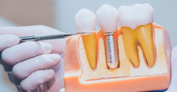 Manequim Odontológico: Como escolher o seu?
