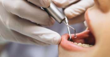 Infecções Fúngicas na Odontologia
