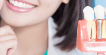 Profilaxia dentária: a eficácia no controle da placa bacteriana