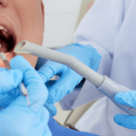 Extração dentária: guia completo - Blog Dental Speed
