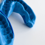 Moldagem com silicone de condensação - Blog Dental Speed