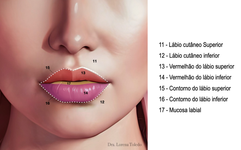 Ilustração anatômica dos lábios com marcações de áreas como lábio cutâneo superior e inferior, contorno do lábio superior e inferior, vermelhão e mucosa labial, com numeração e identificação dos elementos na imagem.