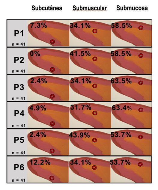Gráfico com seções de tecidos subcutânea, submuscular e submucosa, comparando perfis P1 a P6 com percentuais em cada camada e marcações de pontos