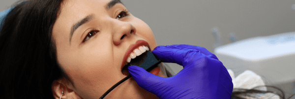 sensor-digital-odontologico