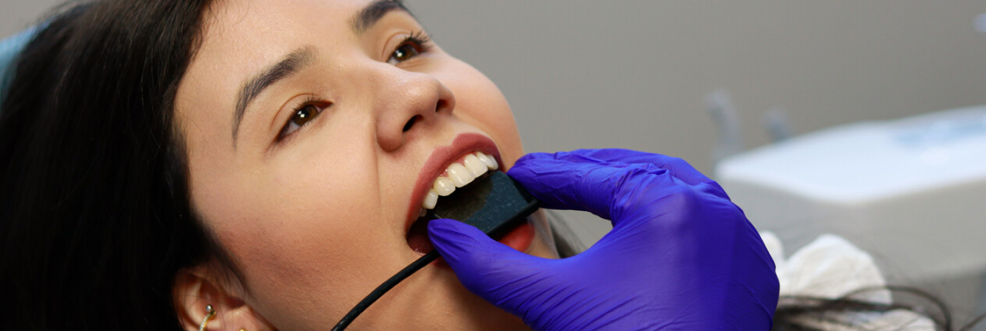 sensor-digital-odontologico