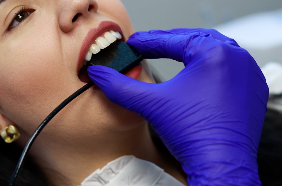 sensor digital odontológico usado na radiologia odontológica
