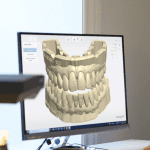 artigos sobre a Odontologia Digital - Blog Dental Speed