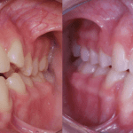 casos clínicos na odontologia