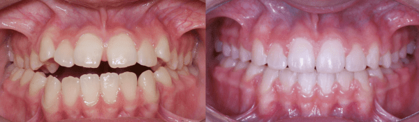 casos clínicos na odontologia
