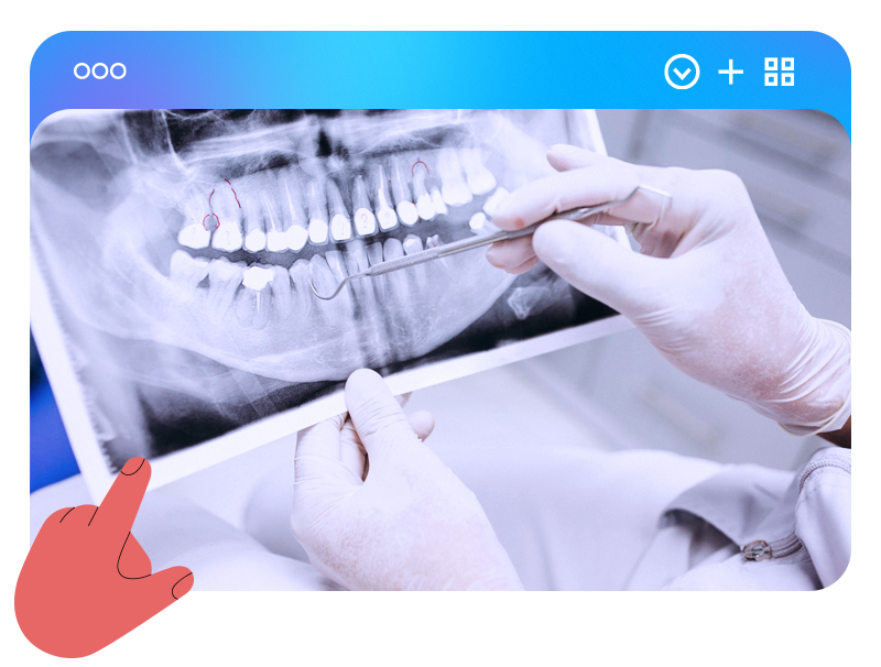 Dentista analisando raio-X odontológico para avaliação da saúde bucal e planejamento de tratamento dentário.