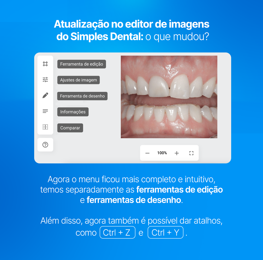 Imagem de dentes com alinhamento imperfeito, demonstrando a importância de mudar para uma correção ortodôntica na clínica dentária.