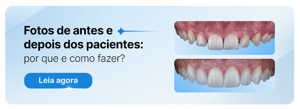 Imagem comparativa mostrando fotos de antes e depois dos pacientes com foco em tratamentos odontológicos, destacando melhorias na aparência dos dentes.
