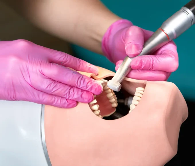 Demonstração de procedimento com broca multilaminada simulada em uma mandíbula de prática, usando equipamentos de alta precisão e luvas rosas para higiene.