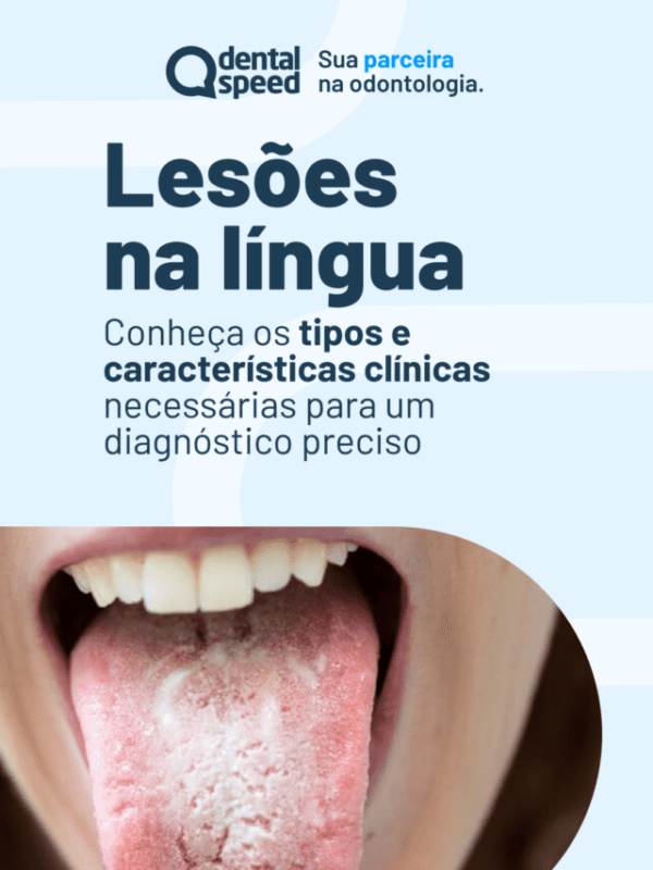 ds-2612-lesoes na lingua-stories 1