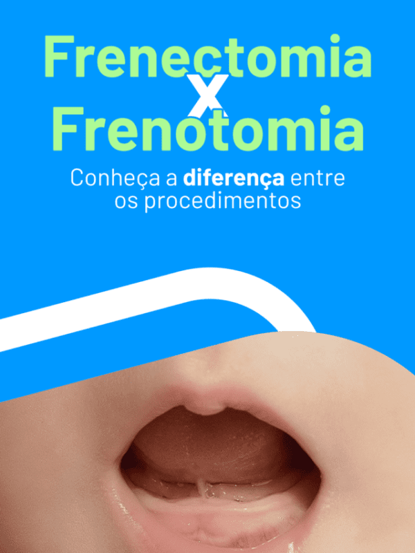 1604_DS-Story-01_Frenectomiaxfrenotomia