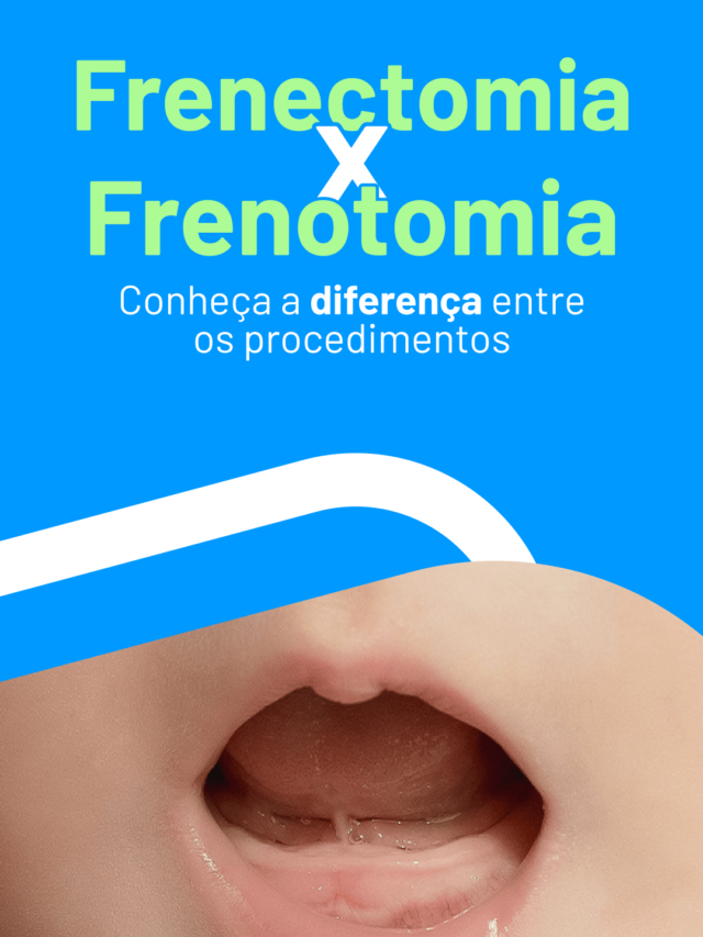 1604_DS-Story-01_Frenectomiaxfrenotomia